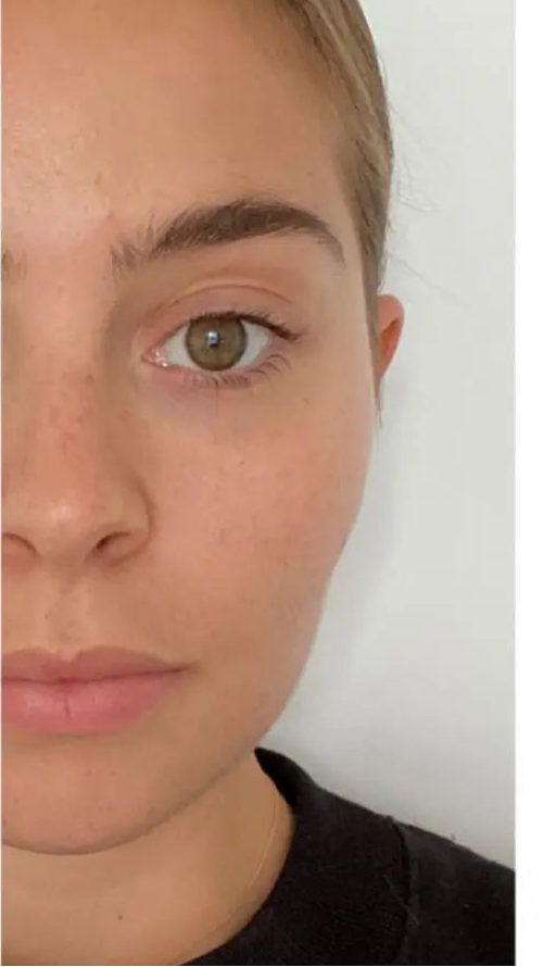 After using Sculpta Facelift Pro