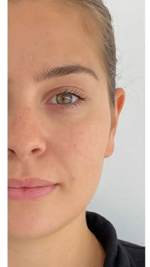 Before using Sculpta Facelift Pro