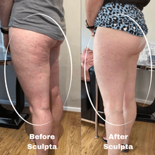 Sculpta device on skin