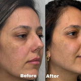 Sculpta FaceLift Pro - Sculpta
